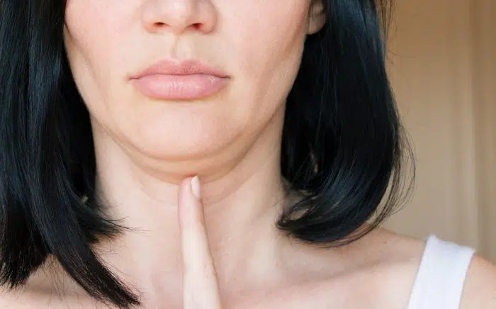 How To Get Rid Of A Double Chin Causes Treatments And Prevention Women Beauty And Health 