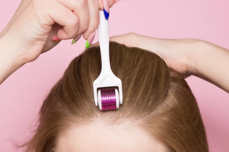 Unlocking Hair Growth The Correct Usage Of A Derma Roller For Optimal Results