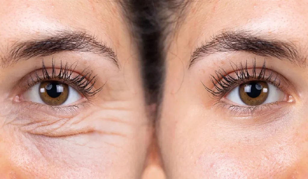 The Ultimate Guide To Understanding Eye Creams Types, Benefits