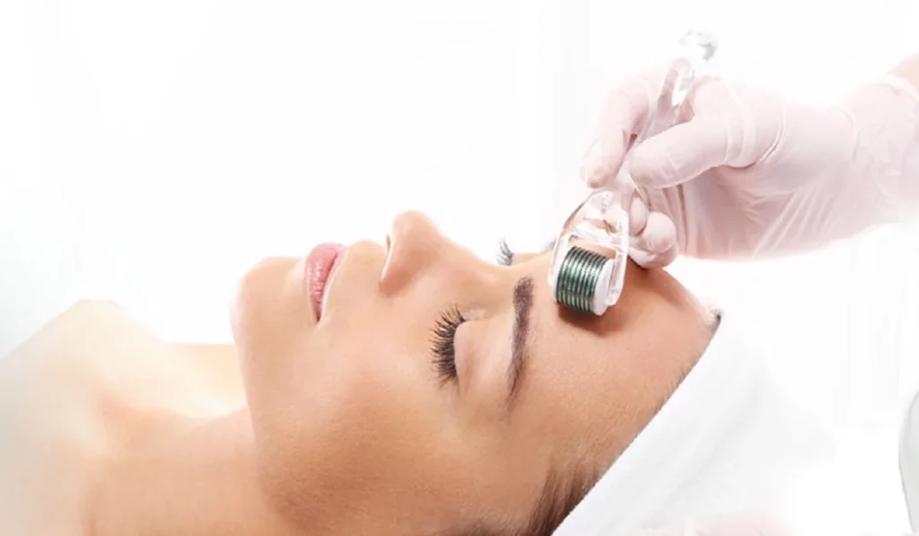 What Is Microneedling Everything You Need To Know